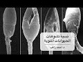 أمراض ذكورة  - نسبة تشوهات الحيوانات المنوية