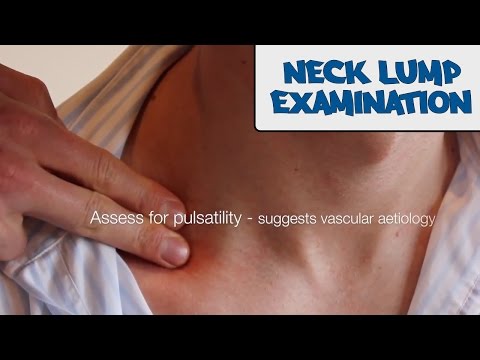 Video: Lump On Collar Bone: Near Throat, Hard, Soft, That Moves And More