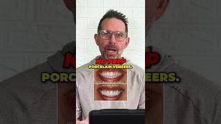 No Prep Veneers A Case Review