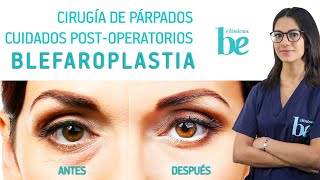 Blefaroplastia O Cirugía De Párpados Cuidados Post-Operatorios Clínicas Be