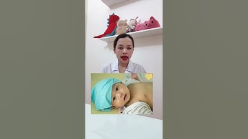 Cách sử lý khi trẻ bị sốt cao co giật ? #chamsoctre #shortvideo #mebimsua #sứckhỏe