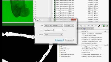 Cortical bone 1: periosteal and endosteal parameters