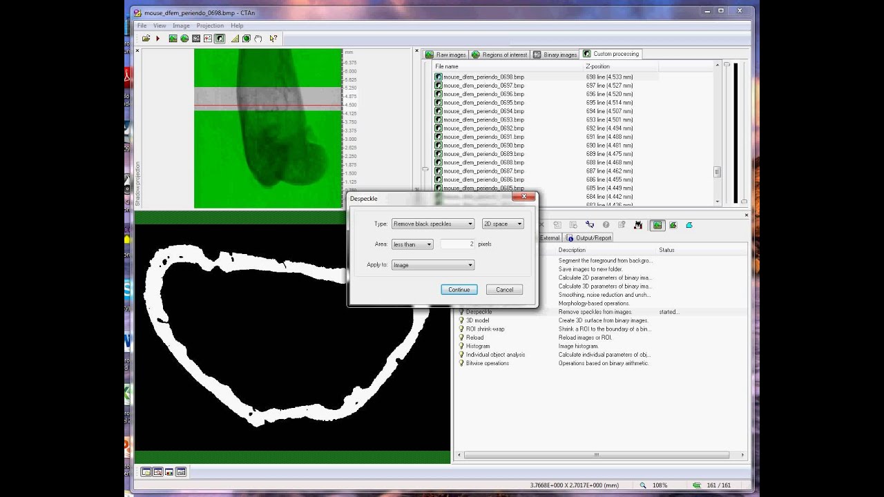Cortical bone 1: periosteal and endosteal parameters