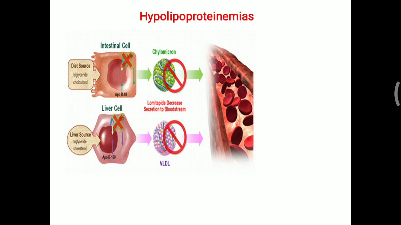 Hypolipoproteinemia - YouTube