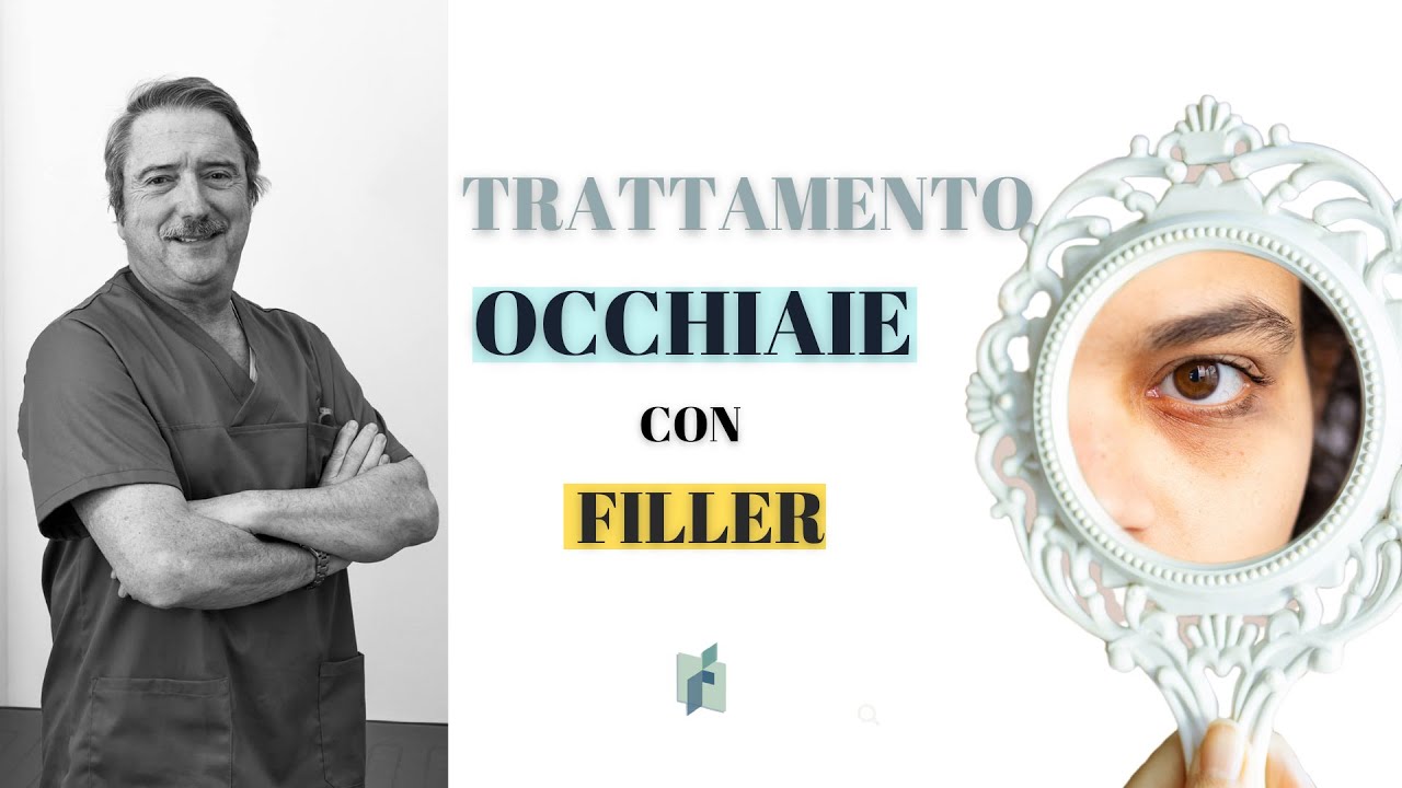 Trattamento occhiaie con filler