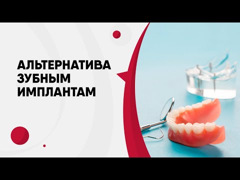 Альтернатива зубным имплантам