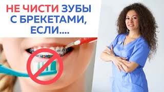 Вот как надо ухаживать за зубами в брекетах! / Как чистить зубы в брекетах?