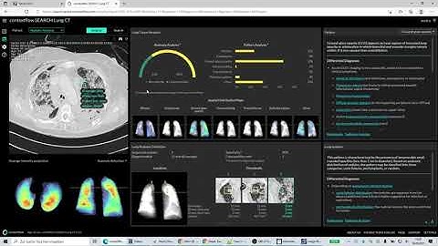Sectra IDS7 CFS Integration