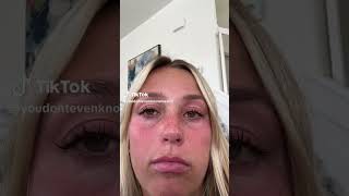 Basically