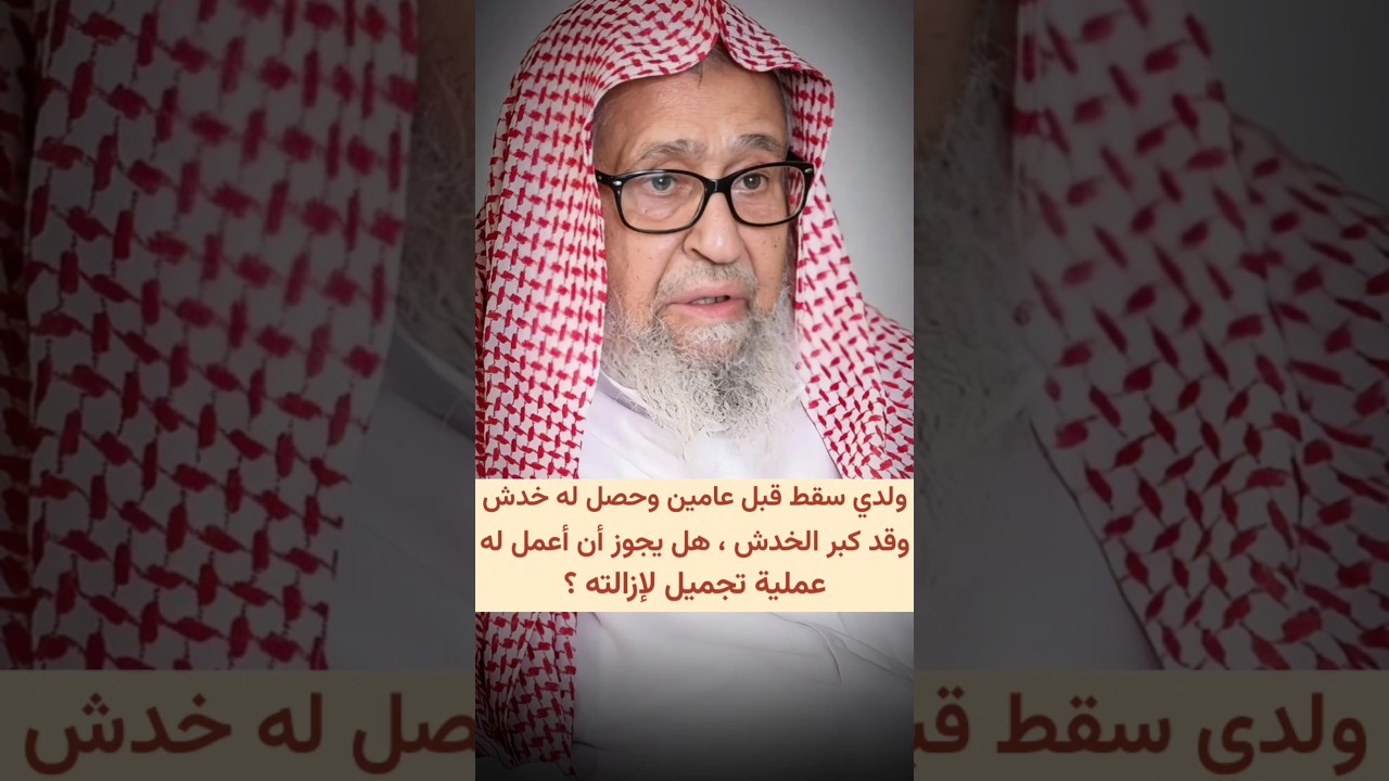 ولدي سقط قبل عامين وحصل له خدش وقد كبر ، هل يجوز أن أعمل له عملية تجميل لإزالته ؟ | صالح الفوزان