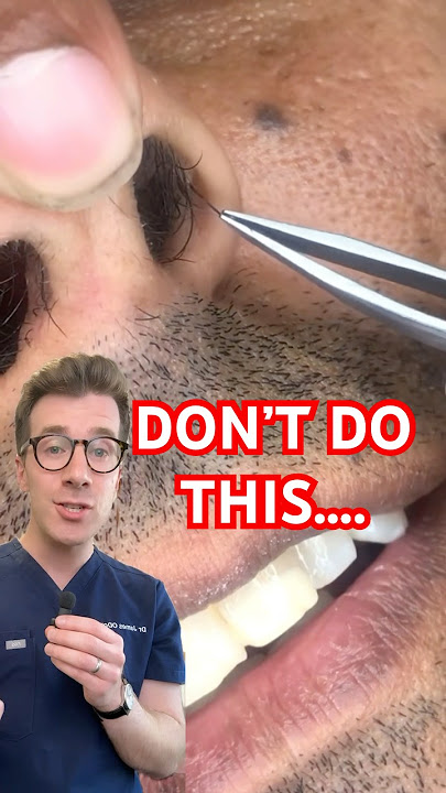 Doctor explains why you shouldn’t pluck NOSE HAIR #shorts #nosehair