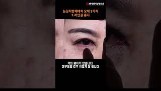 하안검 흉터가 더 잘보인다? (눈밑지방재배치 오해)  -제이제이성형외과#shorts