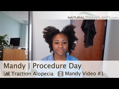 How To Cure Traction Alopecia Naturally How To Cure Traction Alopecia Naturally