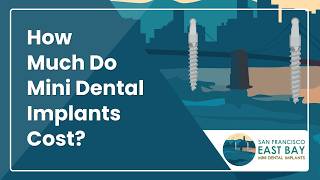 How Much Do Mini Dental Implants Cost? | Dental Implants in San Francisco, CA