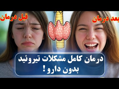 دیگه لازم نیست تا آخر عمر قرص تیروئید بخوری ۴ قدم تا درمان کامل مشکلات تیروئید که به شما نمیگن