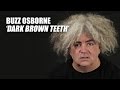 Buzz Osborne Performs 'Dark Brown Teeth'