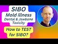 How to test for SIBO V2