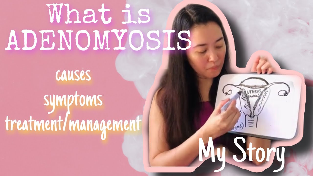 ADENOMYOSIS | Raising Awareness