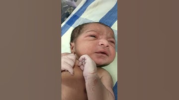 Medical Education Video: Neonatology: Lip smacking movements (Subtle seizures)