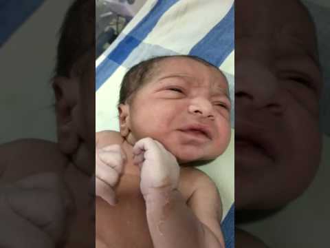Medical Education Video: Neonatology: Lip smacking movements (Subtle seizures)