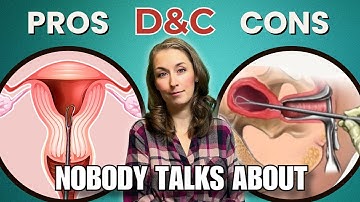 D&C Surgery PROS & CONS Nobody Talks About | Dilation and Curettage