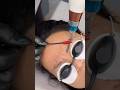 Second removal procedure #tattoo #lasermachine #lasertattooremoval #laserremoval