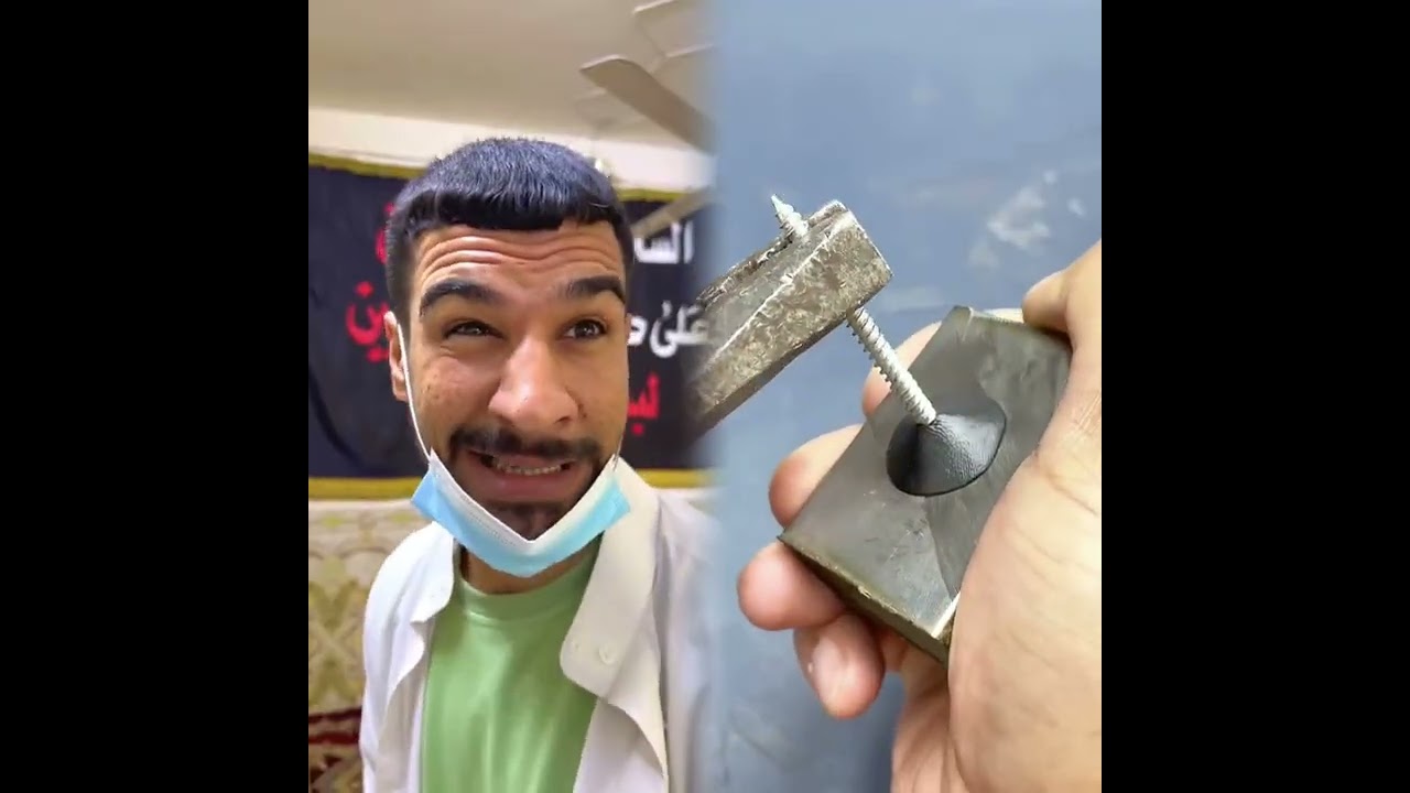 @m_dd60#الطفل الاعمى المعجزه #محضوره_من_الاكسبلور_والمشاهدات #علاوي_مارتن #اكسبلور 15_w