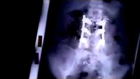 Introduction to EFT, Gary Craig