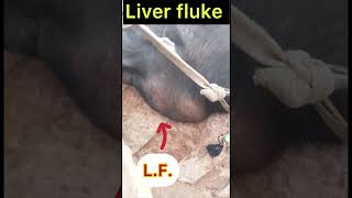 Liver fluke l Dr Umar Khan