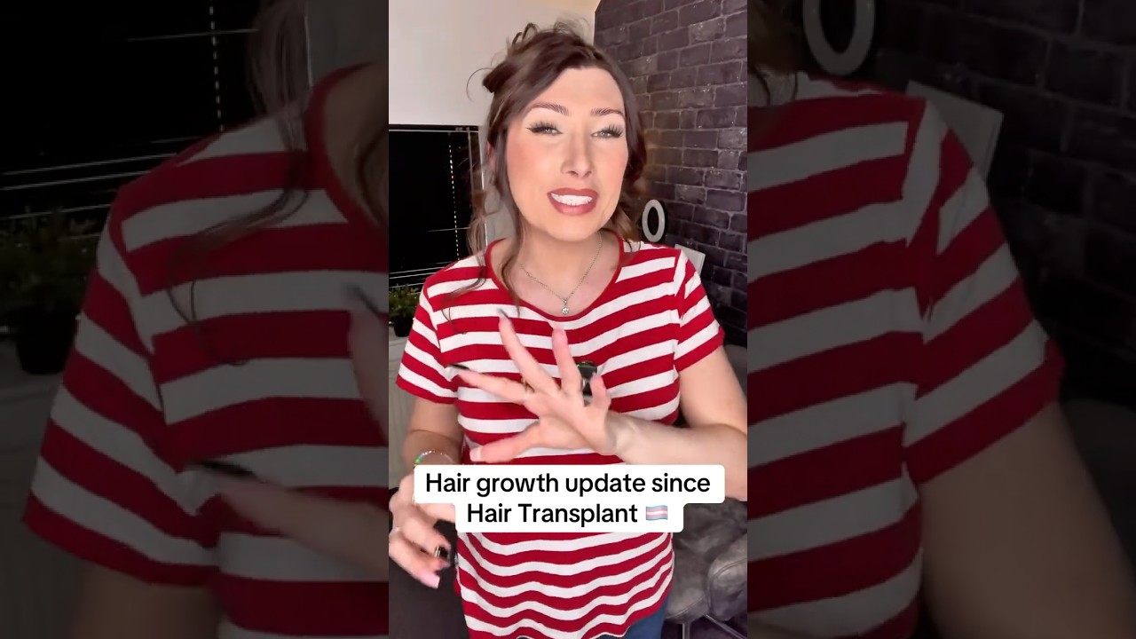 Hair Growth update 🏳️‍⚧️ 