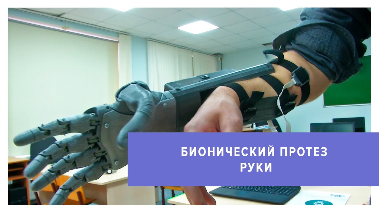Бионический протез руки собирает преподаватель робототехники в ...
