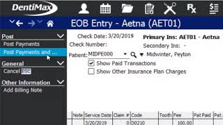 How to Post Insurance Takebacks/Refunds | Dental Software Tip