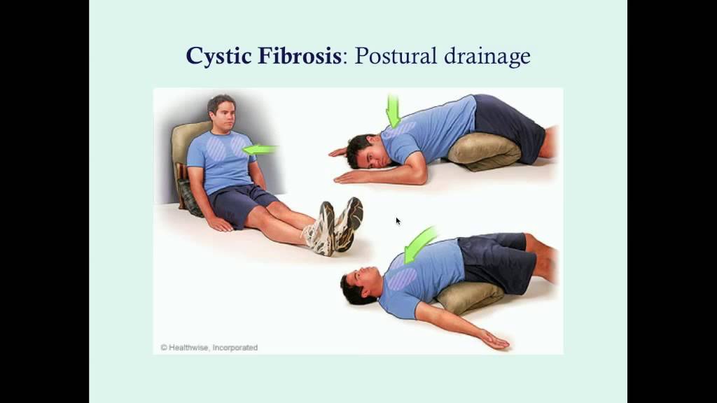 Cystic Fibrosis, Part II - CRASH! Medical Review Series