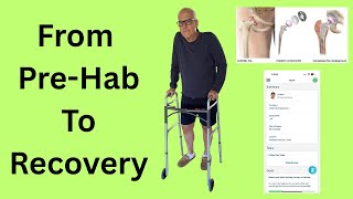 Hip Surgery Update