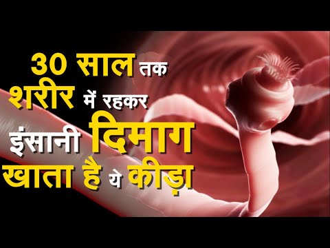 वीडियो: कैसे एक कीड़ा खोजने के लिए