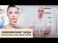 ⭐️Липофилинг лица⭐️ Омоложение лица своим жиром⭐️⭐️