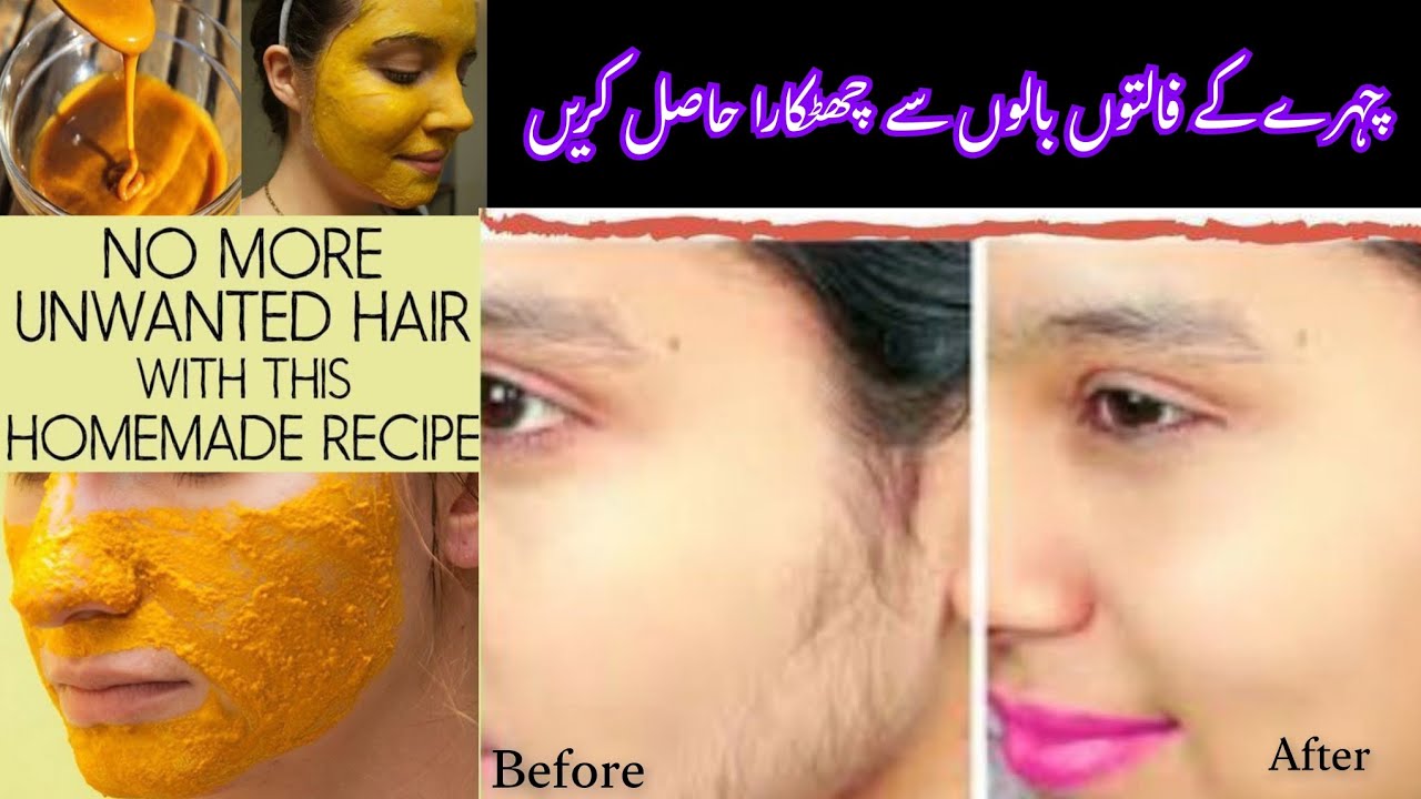 How to Remove Facial Hair Naturally? Remove Unwanted Facial Hair