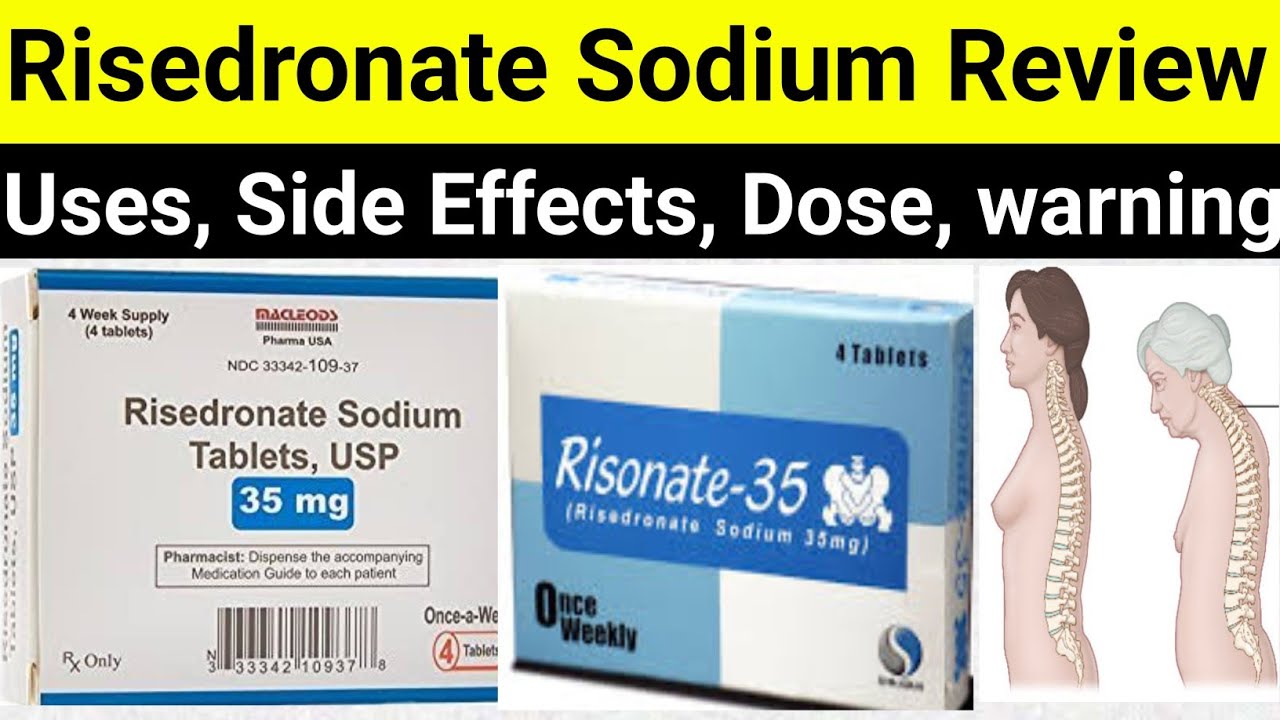 Risedronate sodium 150, 35 mg Reviews - Risonate 150 mg - Uses, Side Effects, Dose