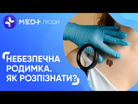 Від родимки до