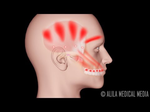 La ATM y el Síndrome de Dolor Miofascial,  Animación. Alila Medical Media Español.