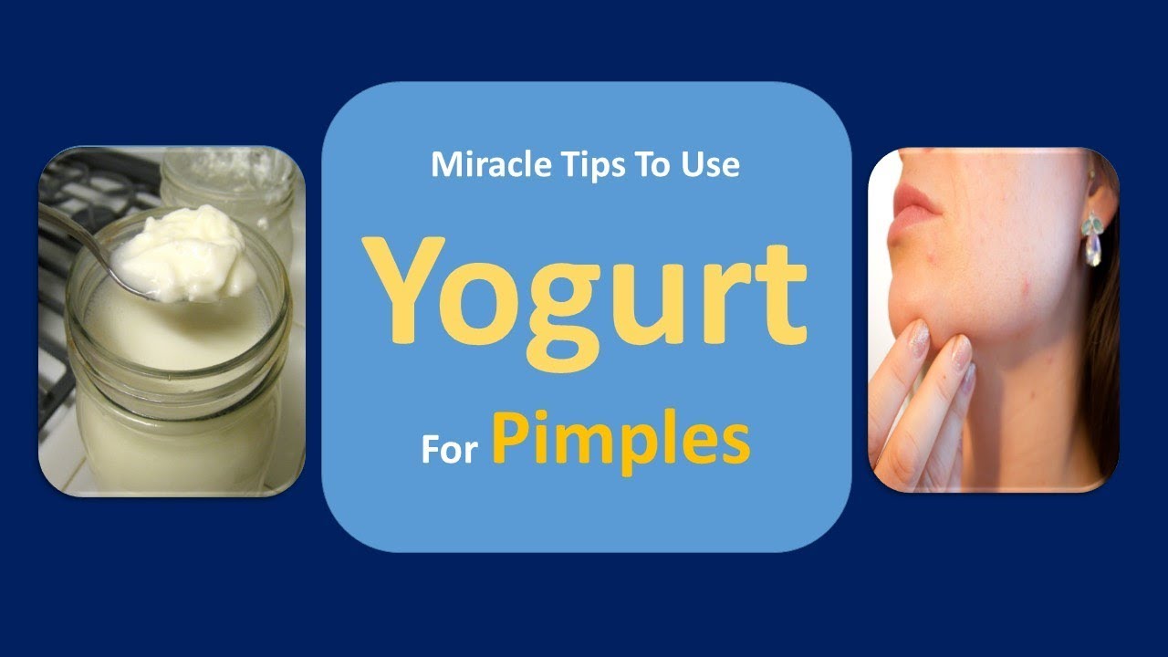 Miracle Tips To Use Yogurt For Pimples - How To Cure Pimple Naturally