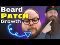 Castor & Peppermint Oil for Beard Growth!? Can fill in patches!