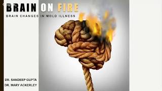 brain on fire webinar brain changes in mold illness with dr mary ackerley