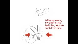 OSOM® TRICHOMONAS TEST