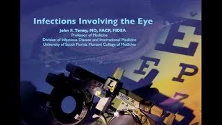 Infections of the Eye -- John Toney, MD