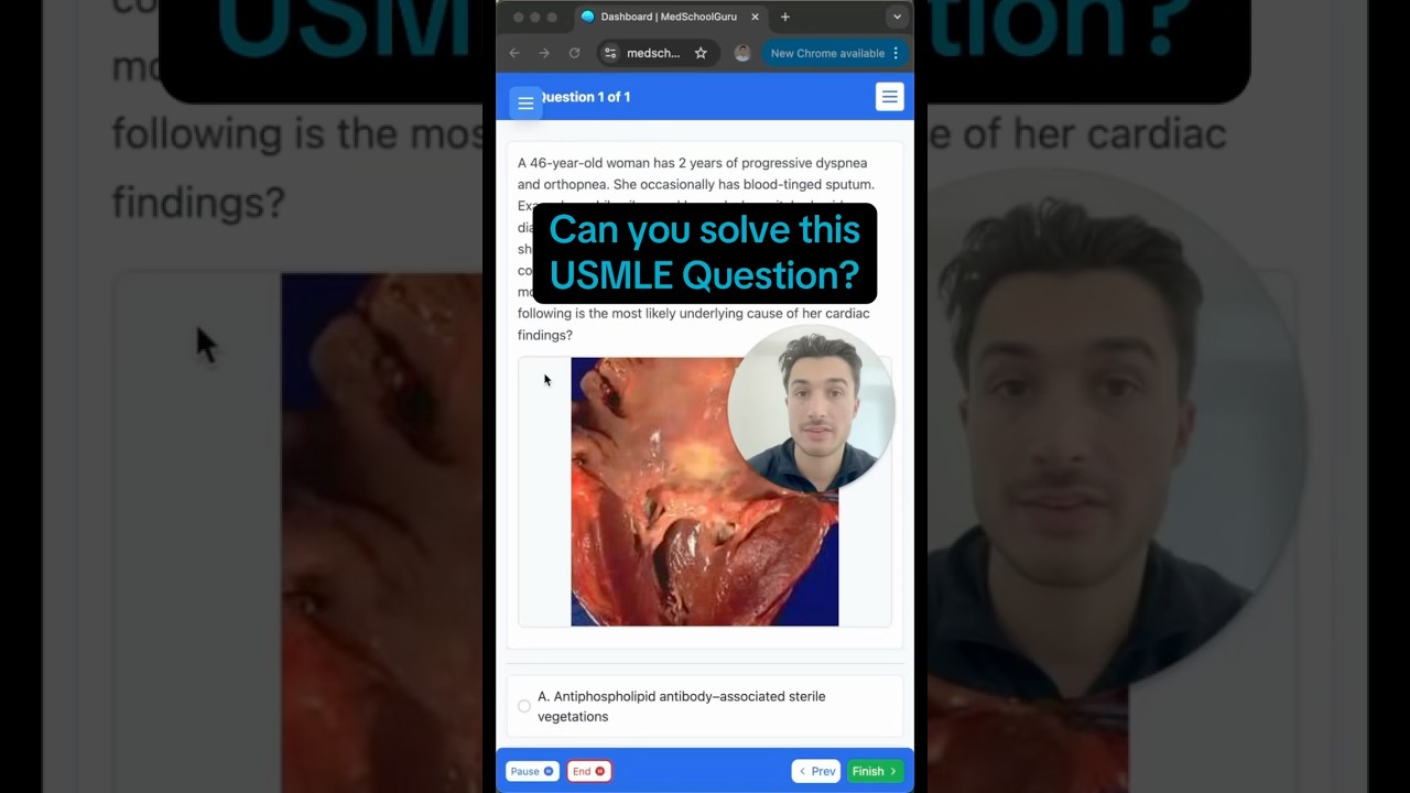 Зайдите на MedSchoolGuru.com, чтобы получить бесплатный доступ к моему банку вопросов и материала...