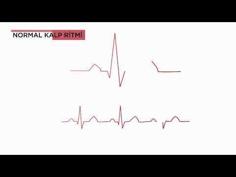 Aritmi (Kalpte ritim bozuklukları) nedir ve neden olur? - Prof. Dr. Ali Oto (Kardiyoloji Uzmanı)