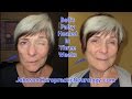 Bell's Palsy Recovery in Three Weeks with Natural Care from Dr. Karl R.O.S. Johnson, DC