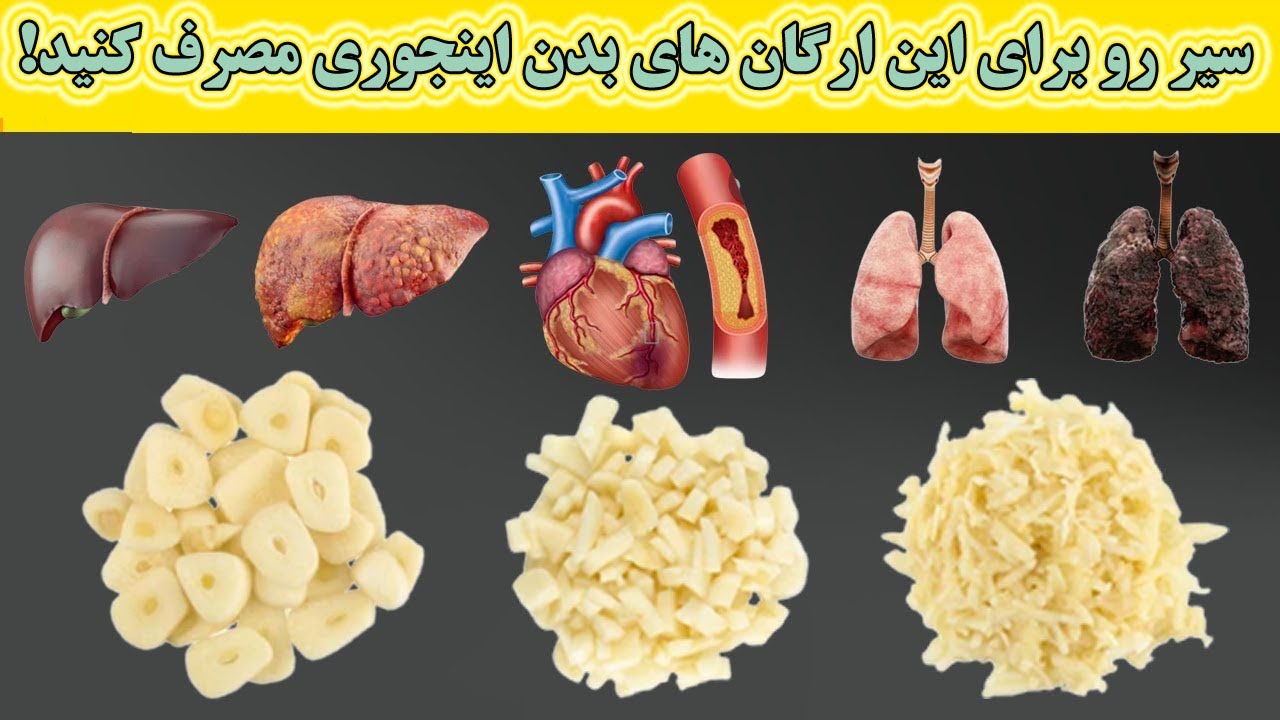 سیر خام رو اینطوری بخورید ، یک معجزه واقعی خوردن سیر 60 دقیقه قبل از خواب از نظر متخصصان تغذیه ...