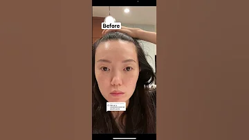 These Were My Results After 1 Month Of Using My Maya Chia Hair Growth Serum Nutrafol Supplements 